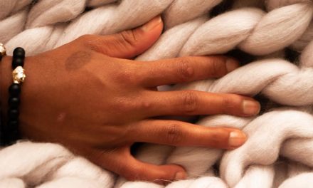 Can You Get Rid Of Birthmarks? Here’s All You Need To Know