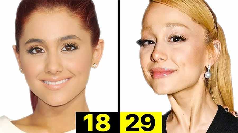 Ariana-Grande.jpg-anorexia