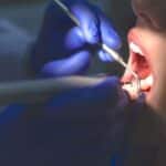 The Most Common Reasons Adults Go See The Dentist